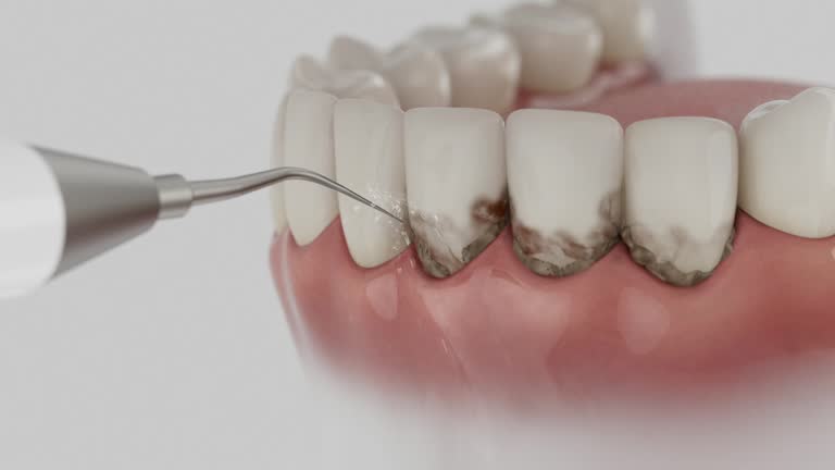 Reliable Root Canal Treatment contractor in Macon County County, NC by Dentist Open Now